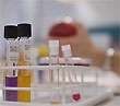Démarche d’achat global en coût/patient au CHU de Poitiers